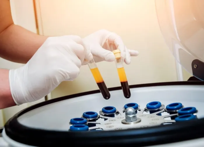 PRP Therapy Benefits: Skin, Hair & Intimate Health