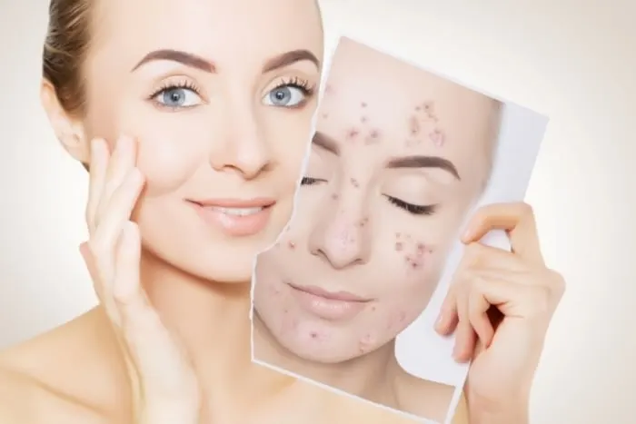 Tixel Skin Treatments with Regenerative Topicals