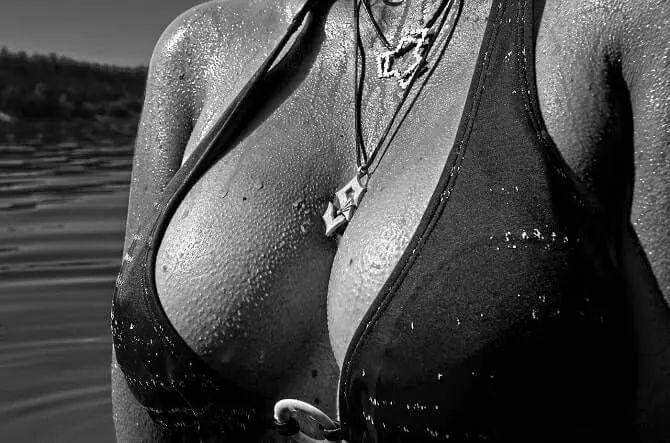 Breast Implants: Not Always Replaced at 10 Years