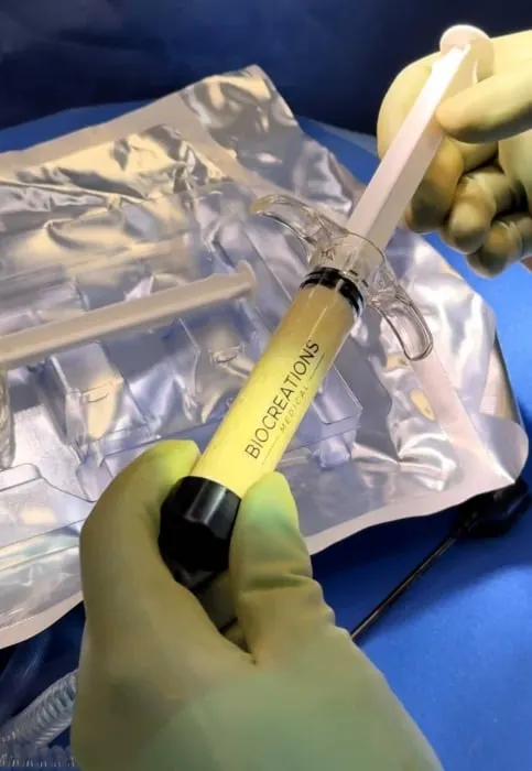 AlloClae Fat Grafting: Restore Lost Volume