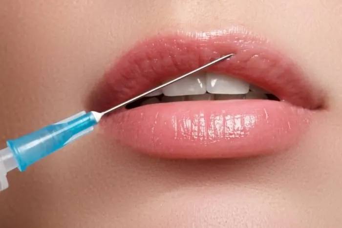 Lip Fillers Guide: What to Know Before Treatment
