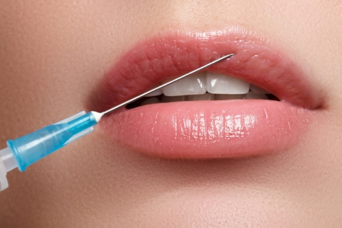 Lip Fillers Guide: What to Know Before Treatment