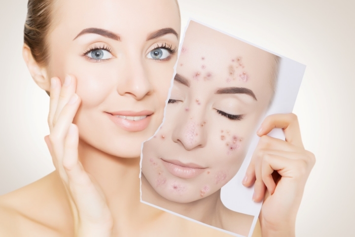 Minimal-Downtime Skin Treatments with Big Results