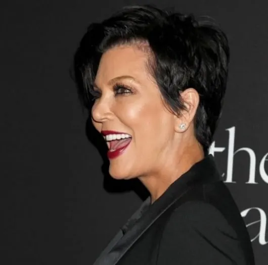 Kris Jenner’s Facelift: Surgery Isn’t the Full Story